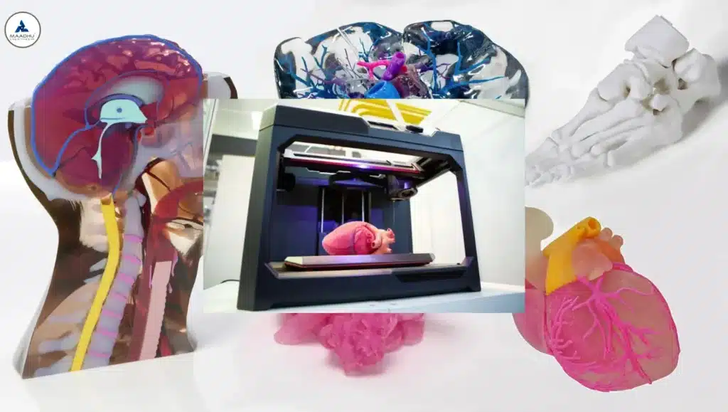 3D Printed Medical Model